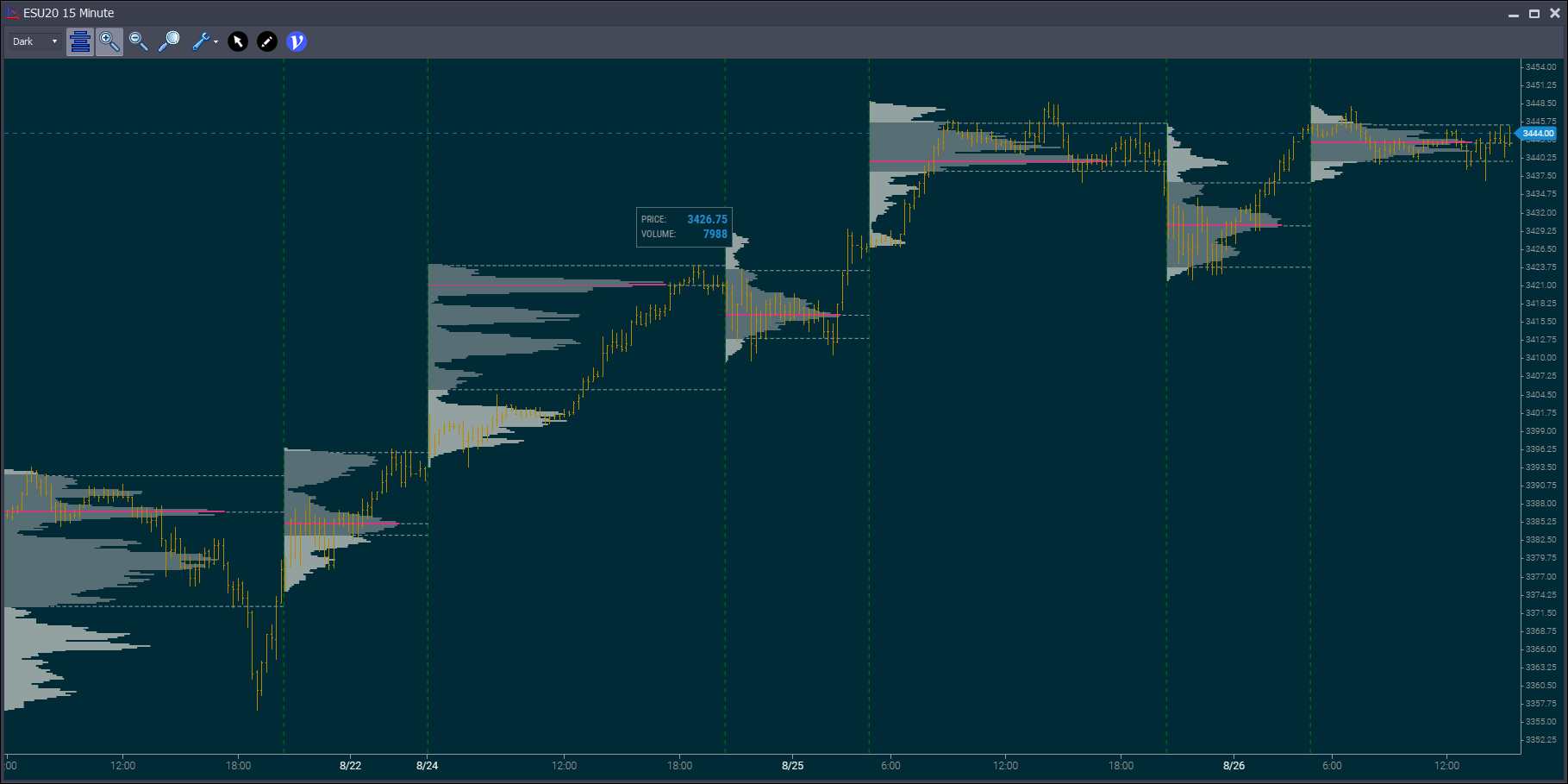 Session Profiles